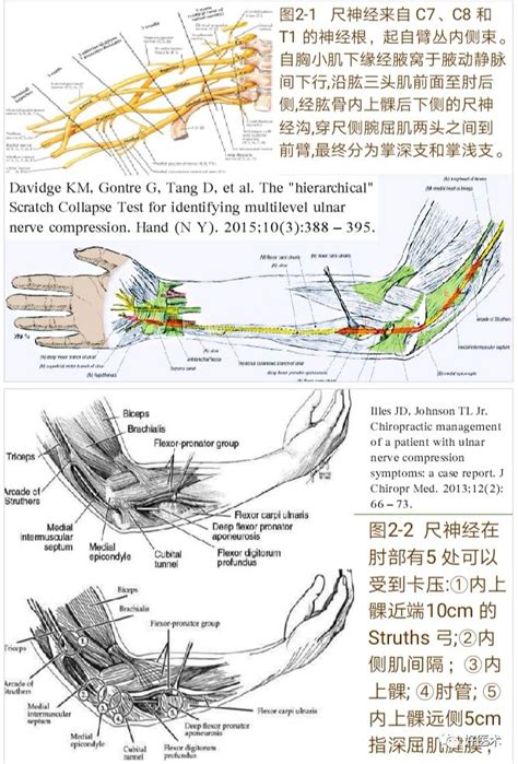 肘意思